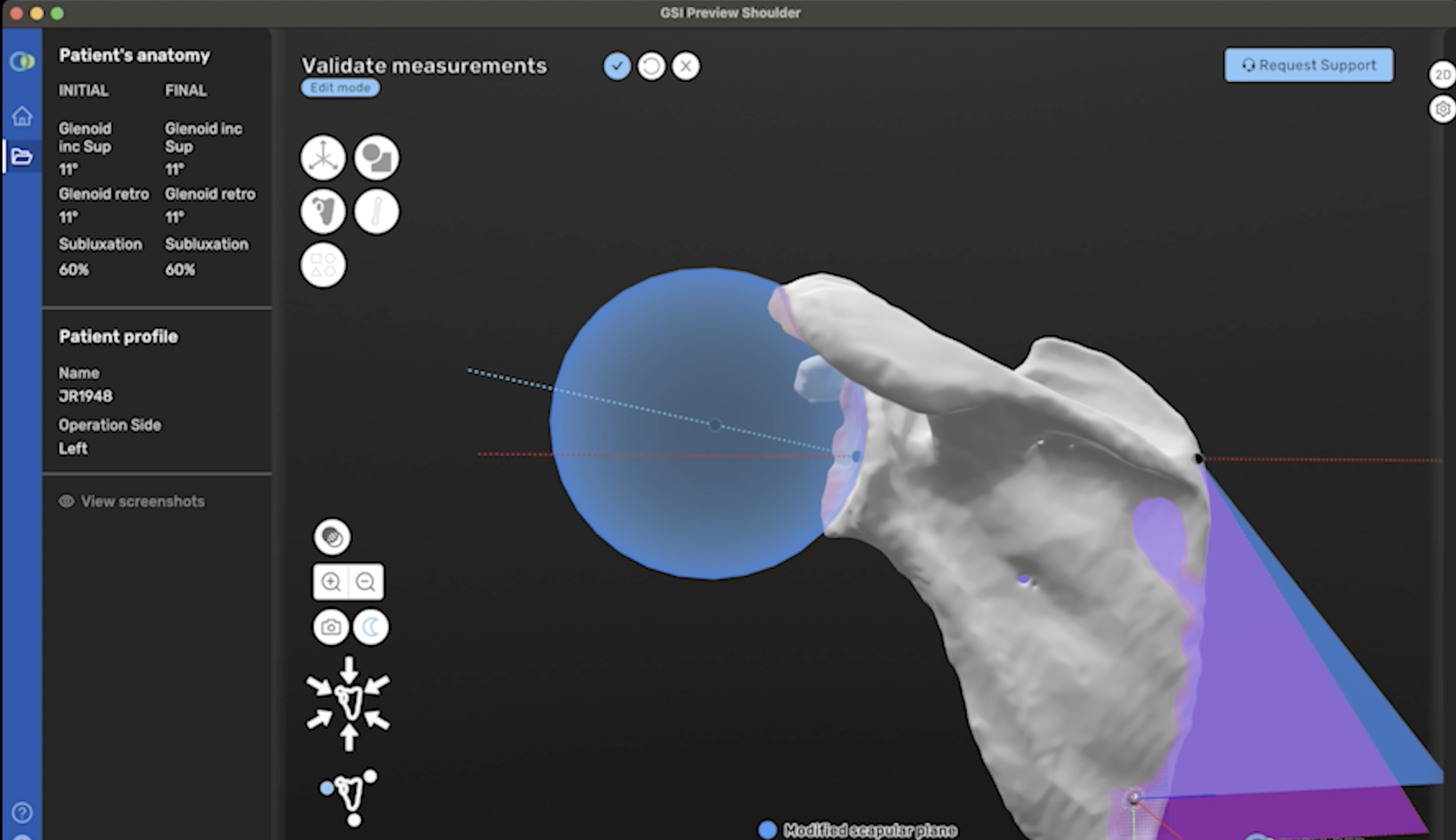Real-Time 3D Surgery Planning Software